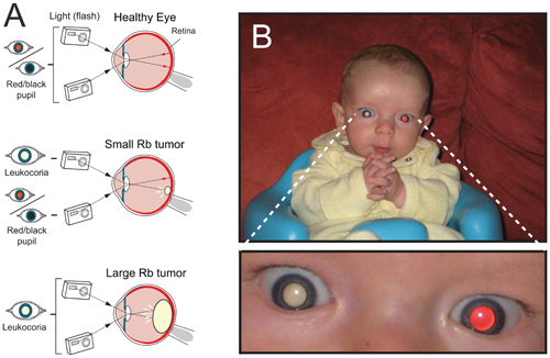 What Ophthalmology and Baby Photos Have in Common