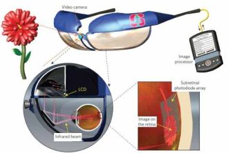 Stanford Retinal Implant Combats Vision Loss