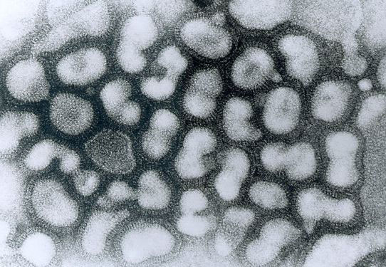 Avian-Like H1N1 Swine Flu May "Pose Highest Pandemic Threat": Study